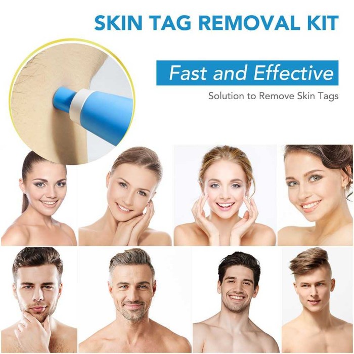 Kutilat Remover ORIGINAL