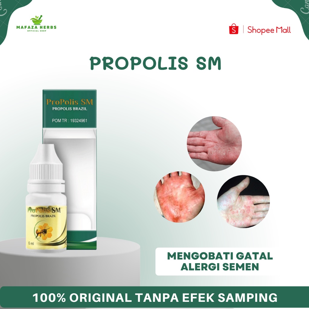 Obat Alergi Semen, Alergi Gatal Kulit, Radang Kulit, Kulit Kering Bersisik, Jari Tangan Kering, Tela