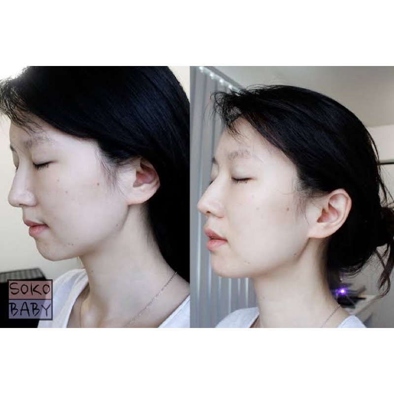 KIEHL’S Clearly Corrective Ampoules For Dark Spot - (PER 1PCS AMPOULE) || 100%ORIGINAL