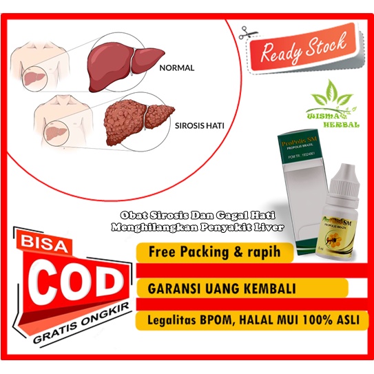 Propolis SM - Obat Sirosis Dan Gagal Hati - Menghilangkan Penyakit Liver | 100% Propolis Brazil, Hal