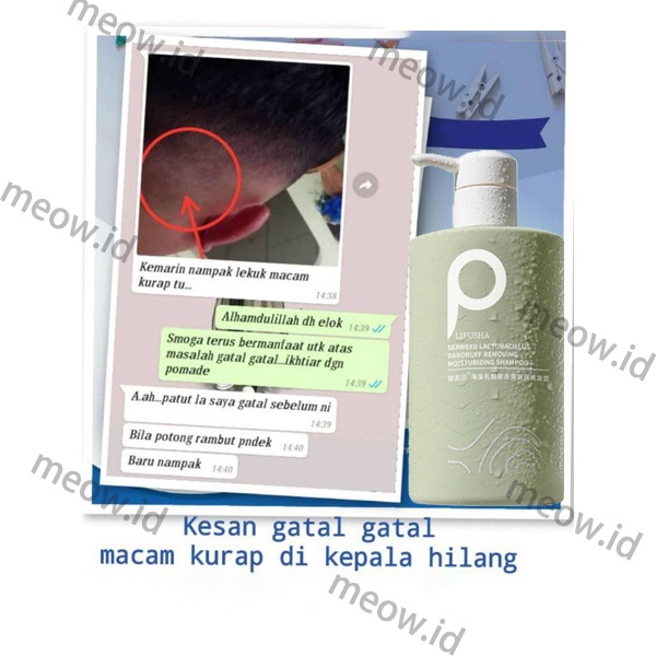 [COD] Shampo anti ketombe Sampo anti ketombe  anti ketombe Obat ketombe 500ml memperbaiki rambut kusut dan kontrol minyak shampo halus lembut dan anti lepek dandruff treatment dermatitis seboroik