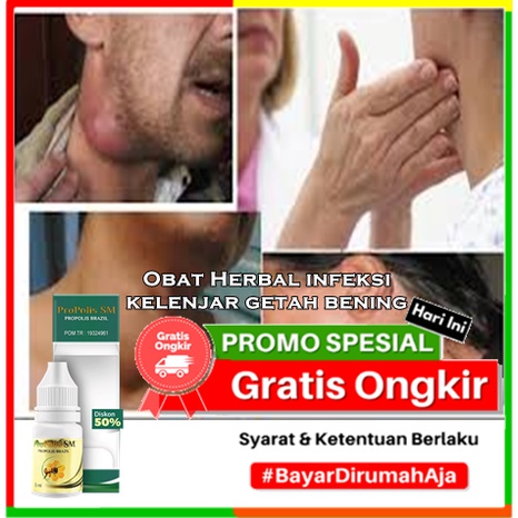 Obat Herbal infeksi kelenjar getah bening Bisa Untuk Anak dan Dewasa  Penghilang (limfadenitis) - de