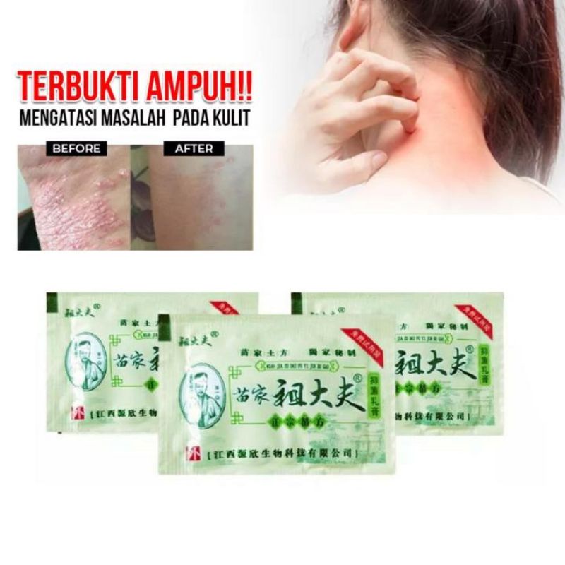 ( Sachet ) Salep ZUDAIFU Asli 100% 2Gr Original Psoriasis Eksim Jamur Kurap Alergi Kulit Cream