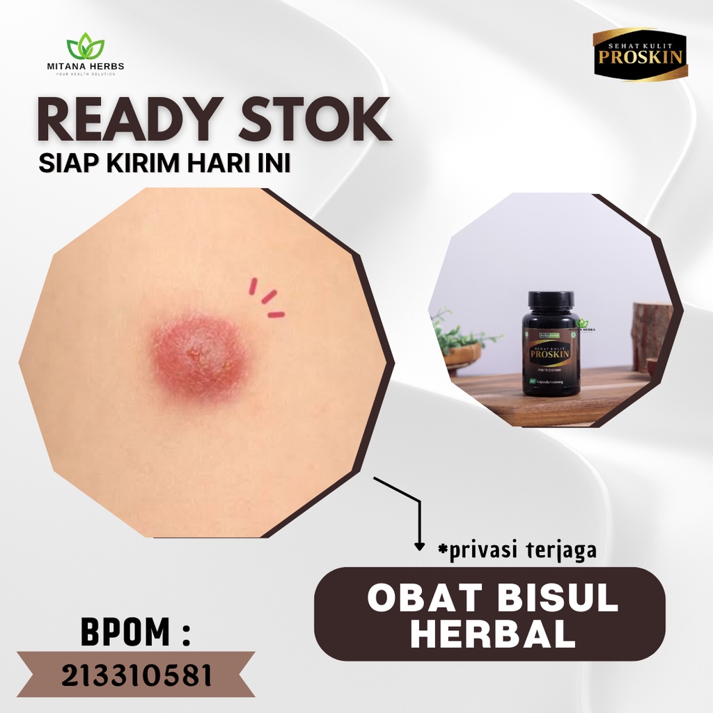 Mitana Herbal - Obat Bisul - Obat Bisul Di Pantat - Obat Bisul Pada Kelamin - Obat Bisul Anak - Obat