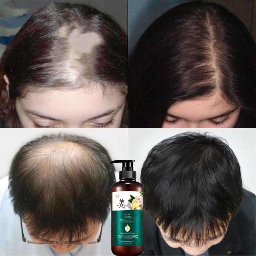 Shampo Penumbuh Rambut Mempercepat Pertumbuhan Shampo Anti Rambut Rontok 500ml Gatal Anti Rambut Rontok Fast Grow Shampoo Perawatan Rambut Rontok