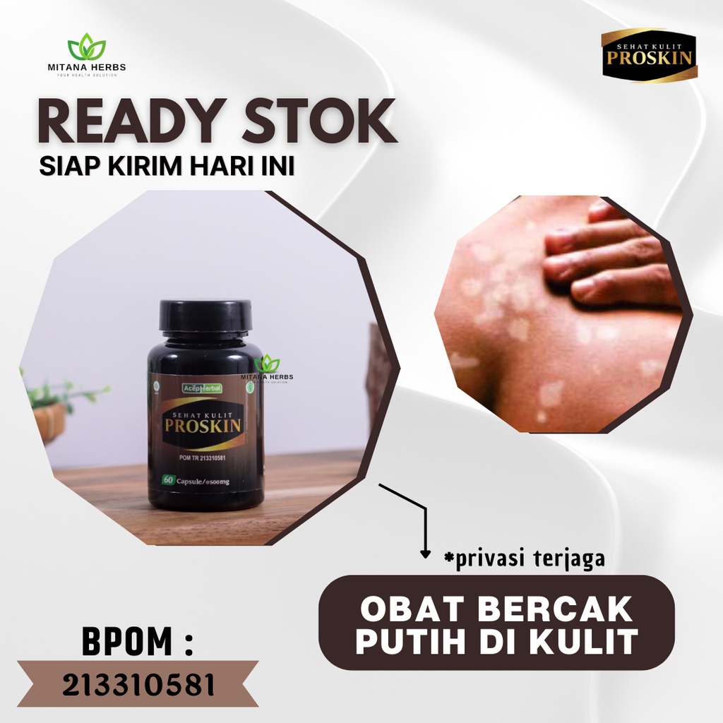 Mitana Herbal - Obat Bercak Putih Pada Kulit - Obat Bercak Putih Di Wajah - Obat Bercak Putih Di Bad