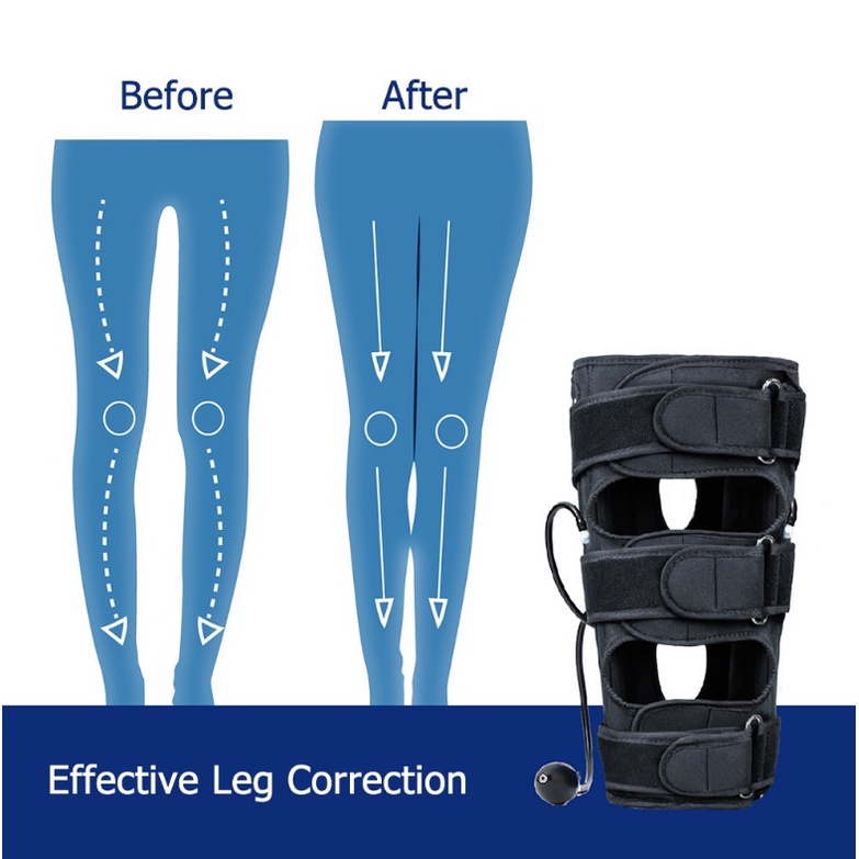 ⭐COD/Garansi⭐Newest Alat Bantu Terapi Meluruskan Kaki O X Leg Correction Untuk Dewasa Aldult ORI Garansi COD CY