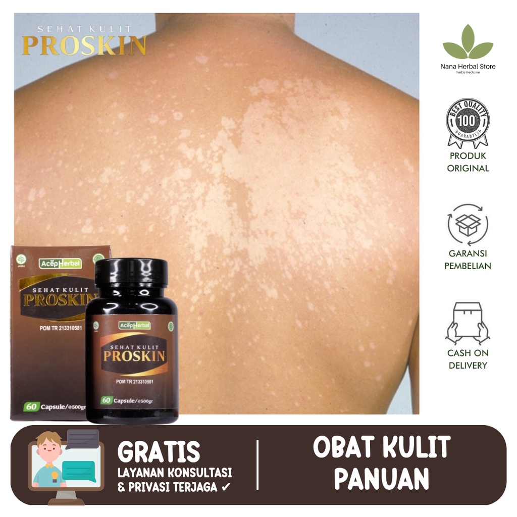 Obat Penghilang Bercak Putih Di Wajah Dan Badan, Obat Balas Bogo, Hapuran Di Wajah Dan Badan, Obat K