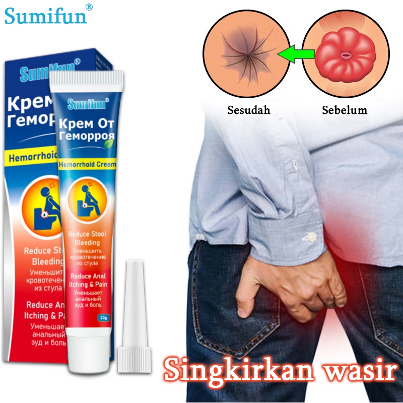 Obat wasir Salep wasir Krim wasir 20G Obat herbal alami, aman dan tidak berbahaya, cepat dan efektif menghilangkan wasir, menghilangkan benjolan, wasir dalam, wasir luar, wasir campuran, gatal pada anus, luka pada lubang anus