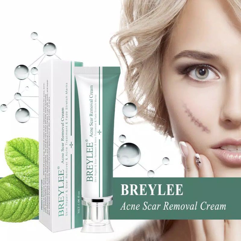 Breylee Acne Scar Removal Cream Menghilangkan Bekas Luka / Stretch Marks 30g