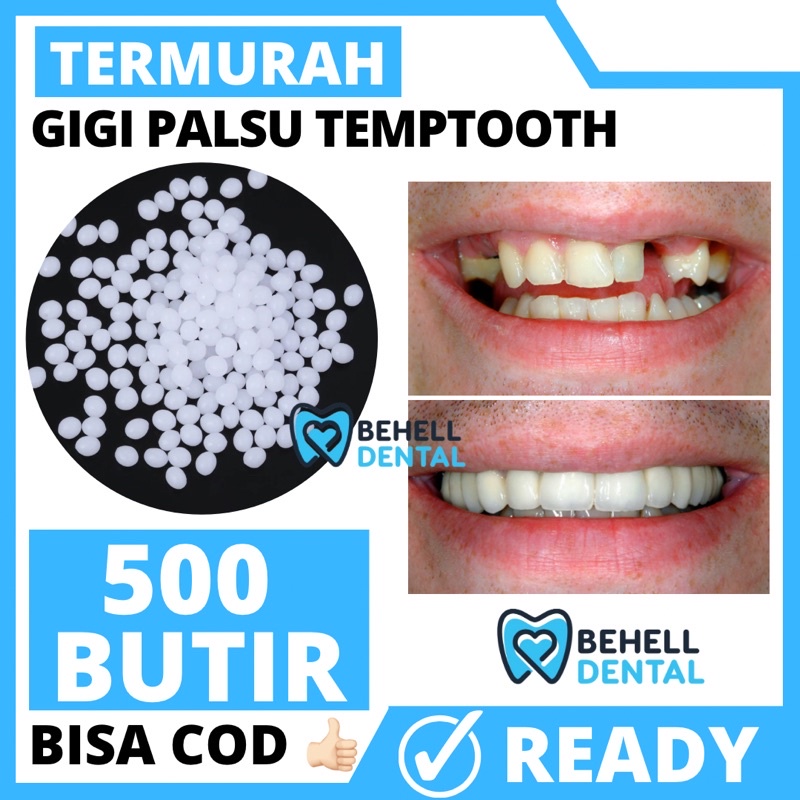 TERMURAH  500 BUTIR TEMPTOOTH GIGI PALSU SEMENTARA PENAMBAL GIGI PATAH RENGGANG / TEMTOOTH / BAHAN TAMBAL GIGI BOLONG BERLUBANG / TEMPORARY TOOTH INSTAN PRAKTIS / TEMPTOOTH GINGSUL PATAH LEM TIRUAN MURAH ORIGINAL ISI 200 / 500 / 400 / 150 / 100 BUTIRi