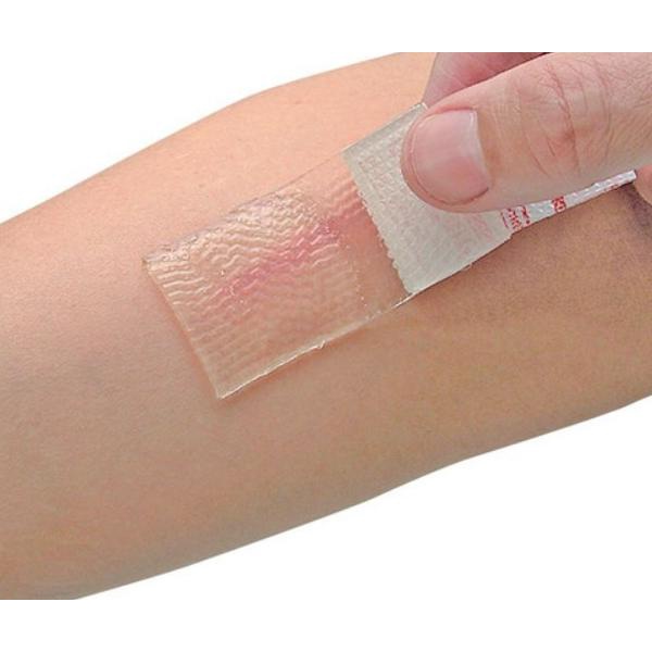 Cica-Care Silicone Gel untuk Keloid