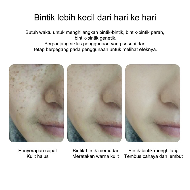 Obat Flek Hitam Bandel Dark Spot Serum Brightening Serum SPOT TREATMENT ACNE SPOT DARK SPOT PORE AWAY Treatment Darkspot Serum Pore Away/Dark Spo Skincare Penghilang Flek Hitam Mencegah Timbulnya Flek Hitam