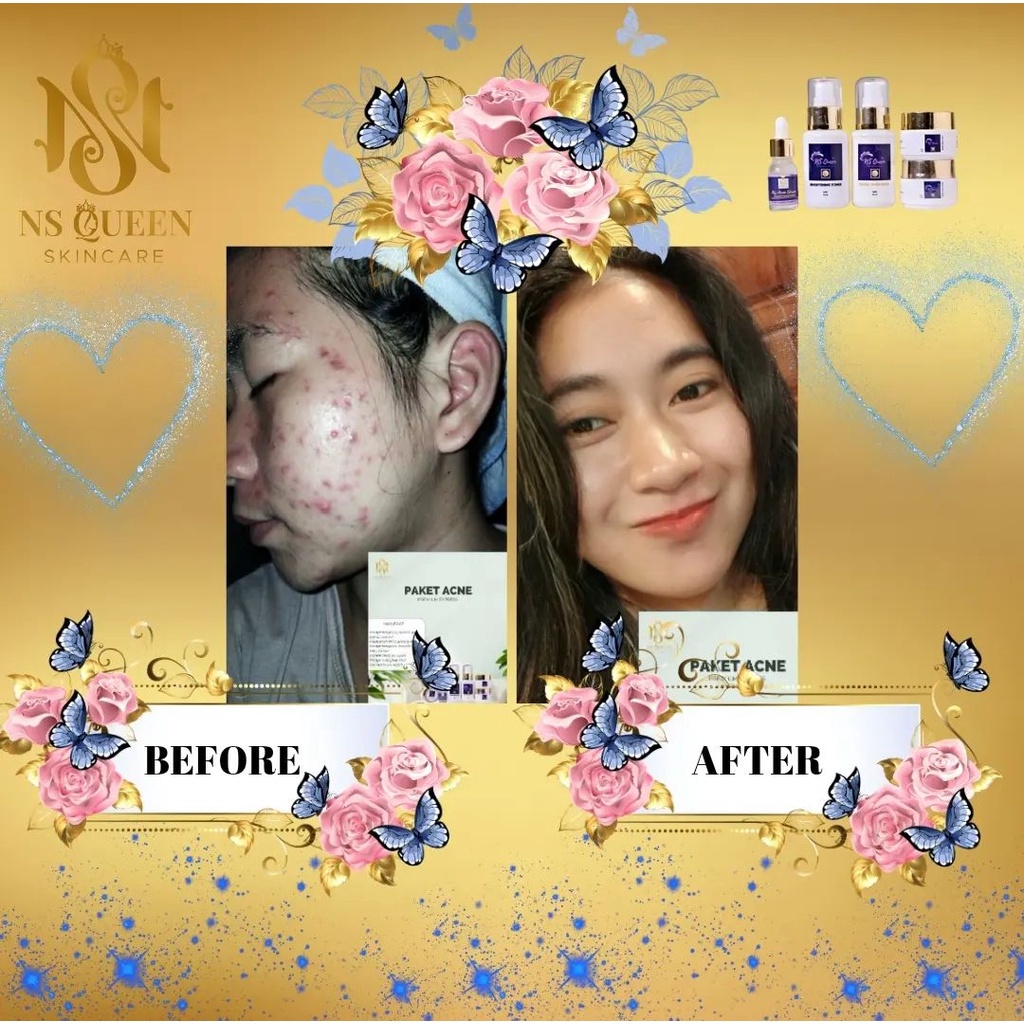 NS Queen Skincare BPOM Original Skincare Bermutu NS Queen Skincare