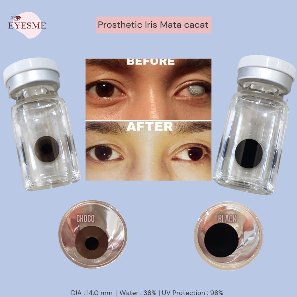 EYESME Softlens Prosthetic Iris Mata Cacat