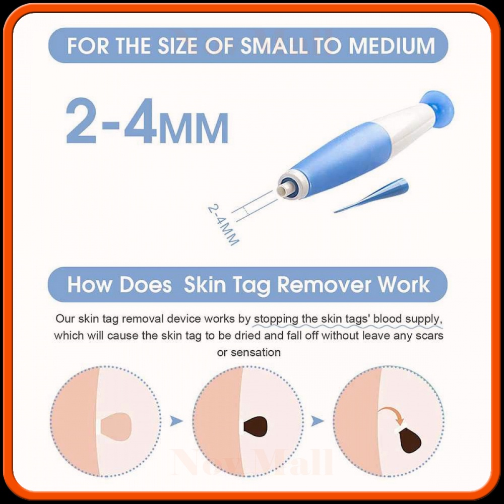 Alat Penghilang Kutil Painless Skin Tag Mole Removal Kit -BY006