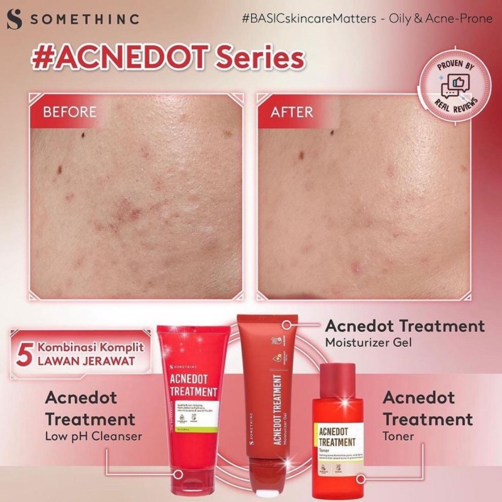 SOMETHINC Acnedot Treatment Kulit Berjerawat (Toner 100 - 40 ml, Moisturizer Gel 25 - 50 ml, Low pH Cleanser 100 ml, Acne Shot AC Spot Gel  15 gr)