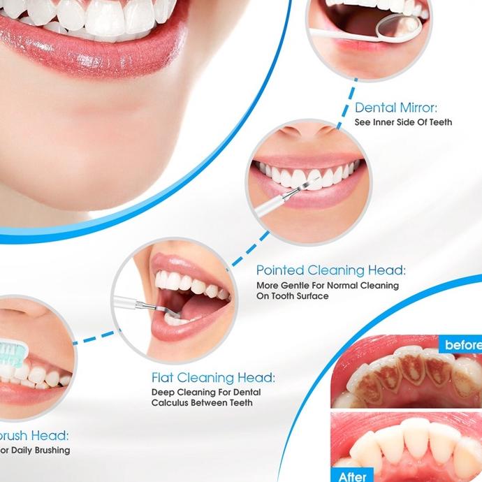 {Original} Kaikki Alat Pembersih Karang Gigi Dental Scaling Sonic Elektrik/  2 in 1 alat pembersih k