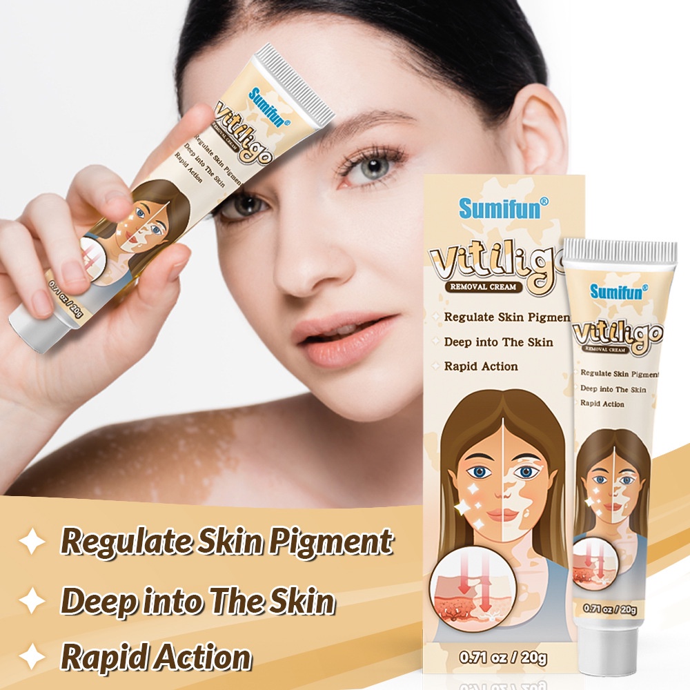 【100% Asli】Mengobati vitiligo Bintik keringat  Bintik belang Vitiligo Bercak putih lainnya Ampuh obat vitiligo paling ampuh  Obat Khusus untuk Vitiligo