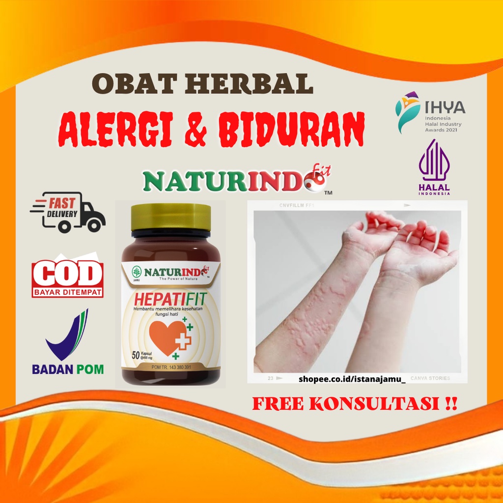 Obat Alergi Gatal Gatal Kulit Biduran Herbal Spesial Atasi Alergi Gatal Biduran Ampuh Hepatifit Natu