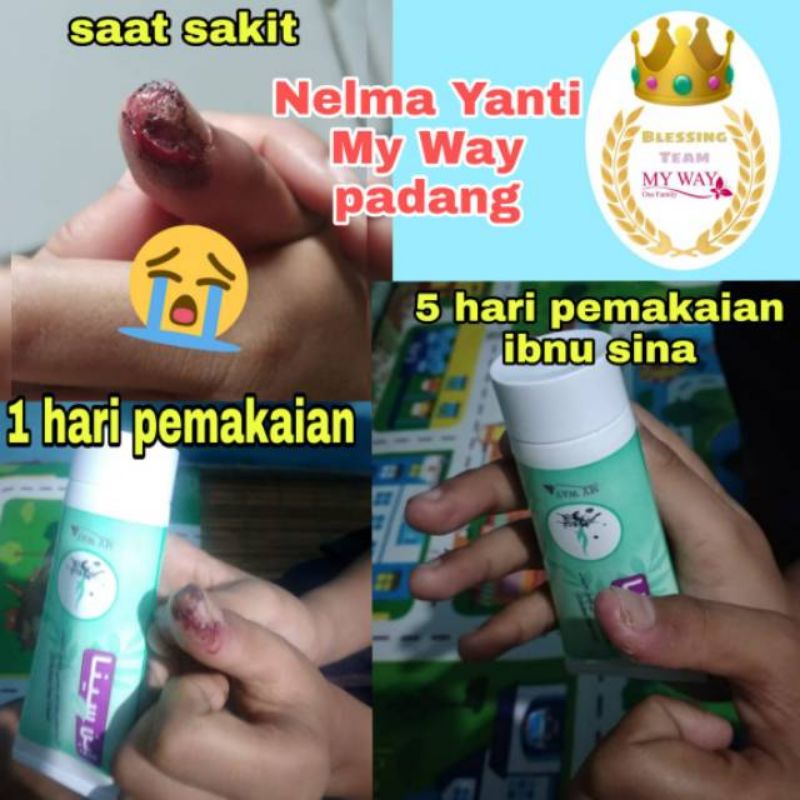 Ibnu Sina MY WAY obat krim  untuk gatal ,kaki pecah pecah, obat luka BPOM