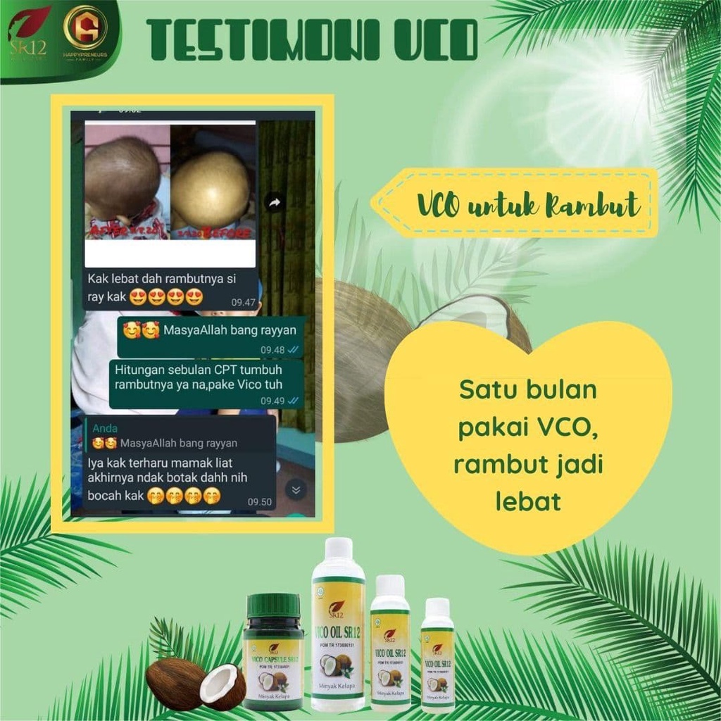 VCO SR12 / MINYAK KELAPA MURNI / MENGATASI RAMBUT RUSAK / MENGURANGI KETOMBE &amp; KUTU RAMBUT