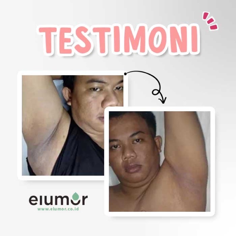 ELUMOR Oxter Cream New Formula Pemutih Ketiak &amp; Pemutih Selangkangan