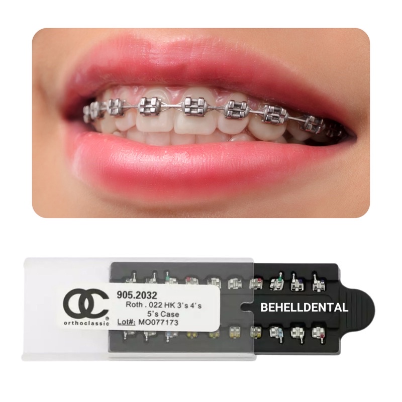 ORI | BRACKET BEHEL METAL ORTHO CLASSIC USA | ROTH KAWAT PERMANEN PERBAIKAN GIGI ORTHOCLASSIC DENTAL