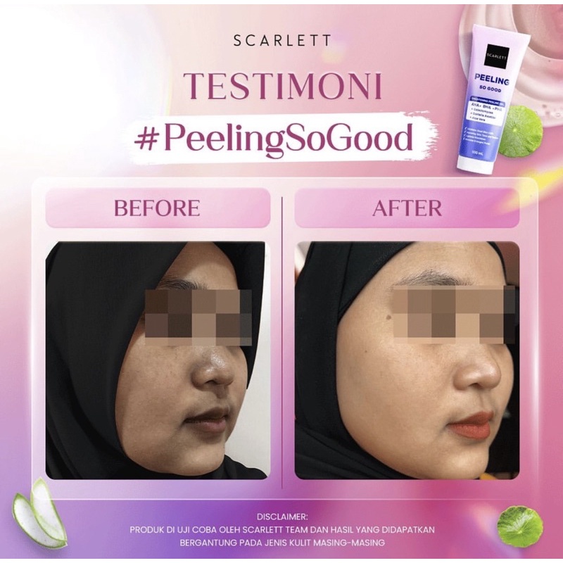 Scarlett Whitening Peeling So Good | Peeling Scarlett