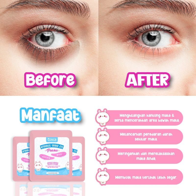 PENGHILANG KANTUNG MATA &amp; KERUTAN MATA - TOSCA HYDROGEL UNDER EYE PATCHES