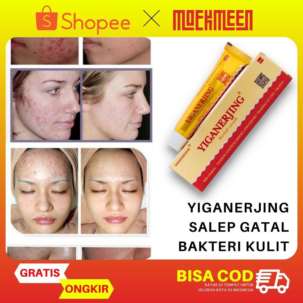 Salep Gatal Yiganerjing Cream Obat Gatal Kulit Herbal Original MStore