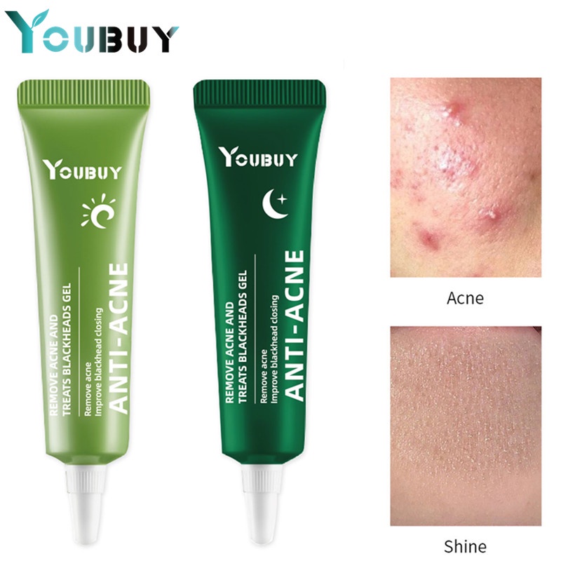 YOUBUY Acne Cream Day&amp;Night  Acne Spot Cream 10gr - Acne Spot Treatment Gel Perawatan Jerawat untuk Menyembuhkan dan Mengempeskan Jerawat