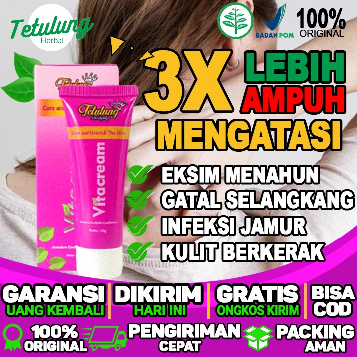 Obat Oles Gatal Selangkangan Salep Gatal Selangkangan Obat Selangkangan Gatal Dan Hitam Obat Selangk