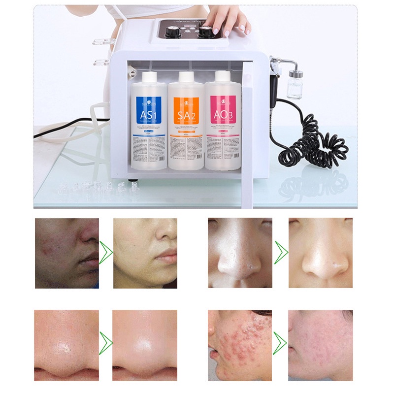 Cairan Hydra Serum Hydra Peel Korea Aqua Dermabrasion Oxygen Spray AS1 SA2 AO3