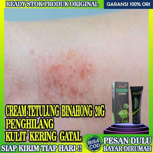 Jual Obat Kulit Kering Dan Gatal,Cream Binahong 20g,Salep Ampuh Tangan Terkelupas, Obat Gatal