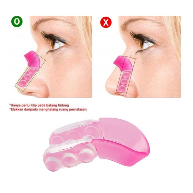 Nose Up Clipper - Hidung Mancung / Alat Pemancung Hidung Teknologi