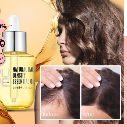 Big Sale PURC HAIR GROWTH SERUM Pelembab rambut Minyak Esensial Jahe Perawatan perbaikan rambut keri