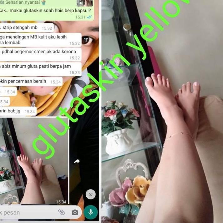 

↪ Distributor resmi glutaskin yellow ber id card || gluta yellow vitamin dan pemutih tubuh fda thailand テ