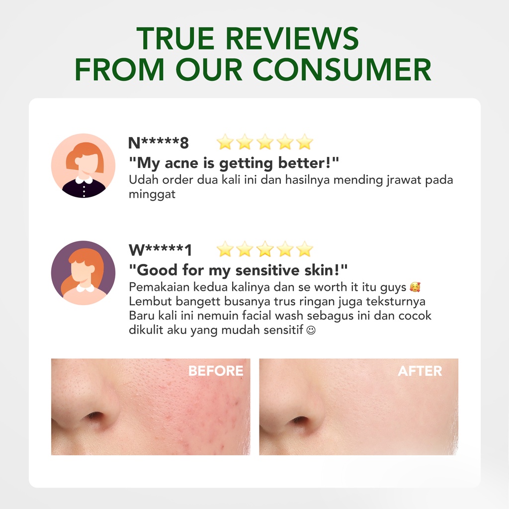 YOU Hy! Amino AC-Ttack Anti-Acne Facial Wash | Jerawat | Kulit Berminyak Image 6