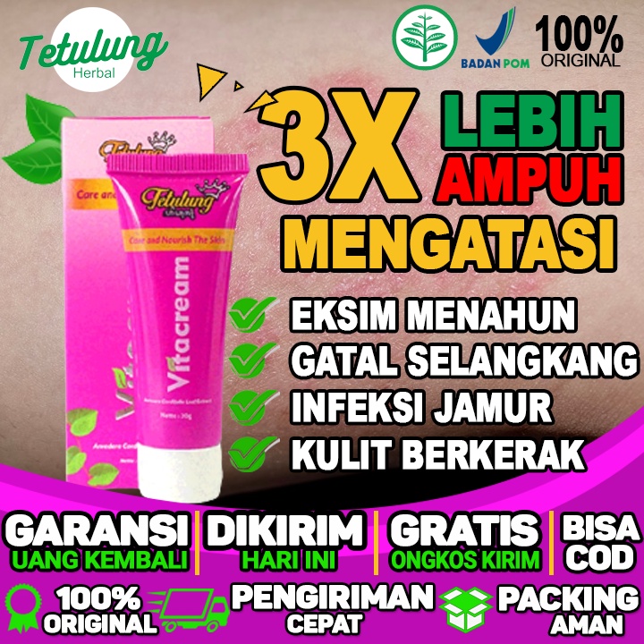 Obat Salep Gatal Selangkangan Menahun Ampuh Salep Gatal Selangkangan Dan Kemaluan Vitacream 20g