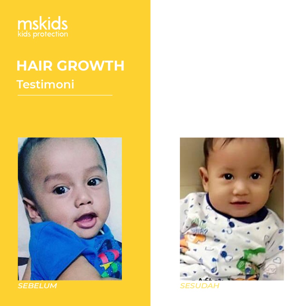 MS Glow Kids Original Hair Growth Shampoo MS Kids by ms.glowofficialbandung
