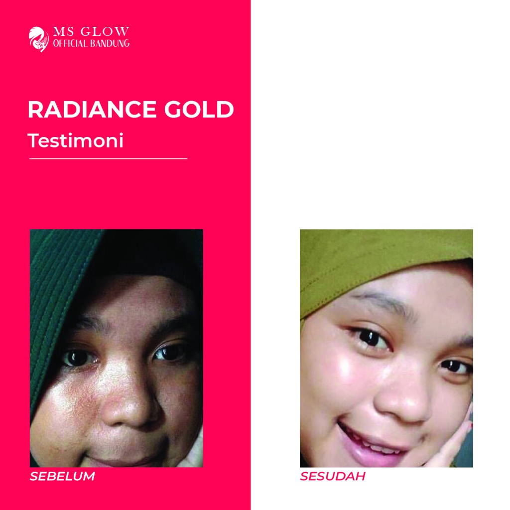 Radiance Gold MS Glow / Pelembab Wajah / Perawatan Kecantikan Berkualitas - By Msglowofficialbandung