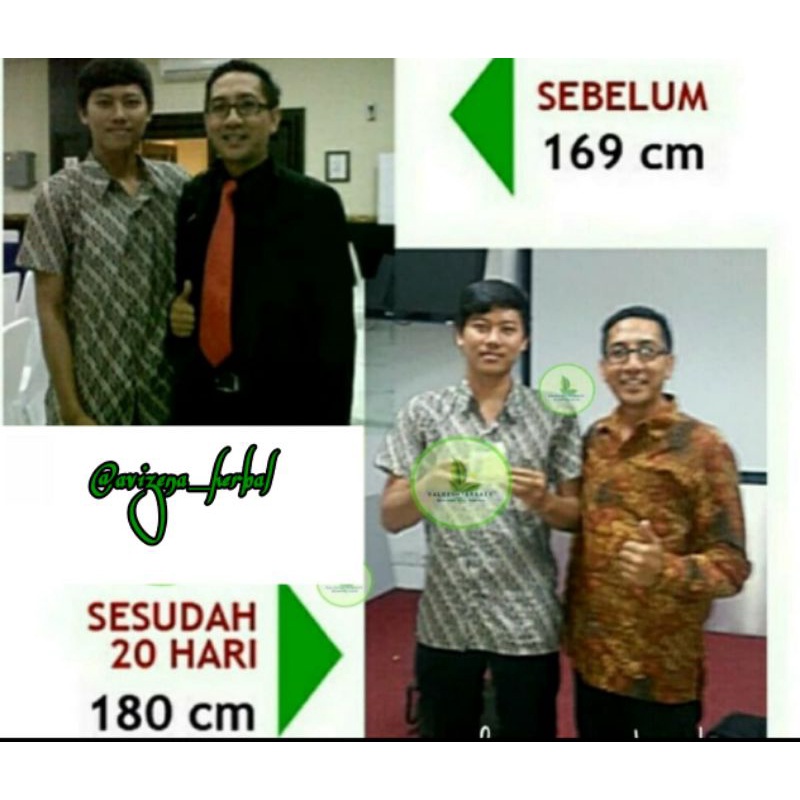 [TERLARIS] ZEVIT GROW PENINGGI BADAN OROGINAL | KAPSUL DAN SUSU | PENAMBAH TINGGI BADAN TERBAIK | ZI