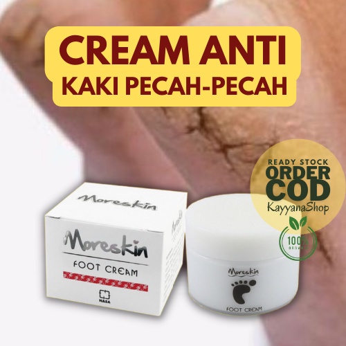 Krim Kaki Kering / Krim Kaki Pecah Dan Kering Ampuh / Cream Kaki Kering Dan Kasar / Kaki Pecah Dan K