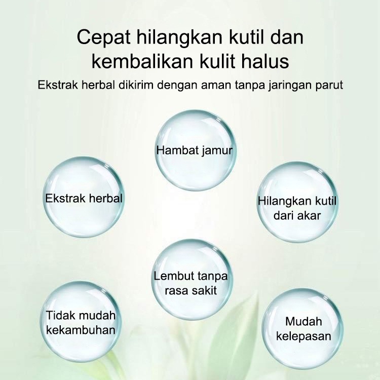 Obat Kutil kelamin HPV , Obat Perontok Kutil 20g, LOTION PENGHILANG KUTIL DAN TAHI LALAT Penghilang Papiloma di Leher dan Wajah, Menghilangkan Kutil Tahi Lalat Mata Ikan