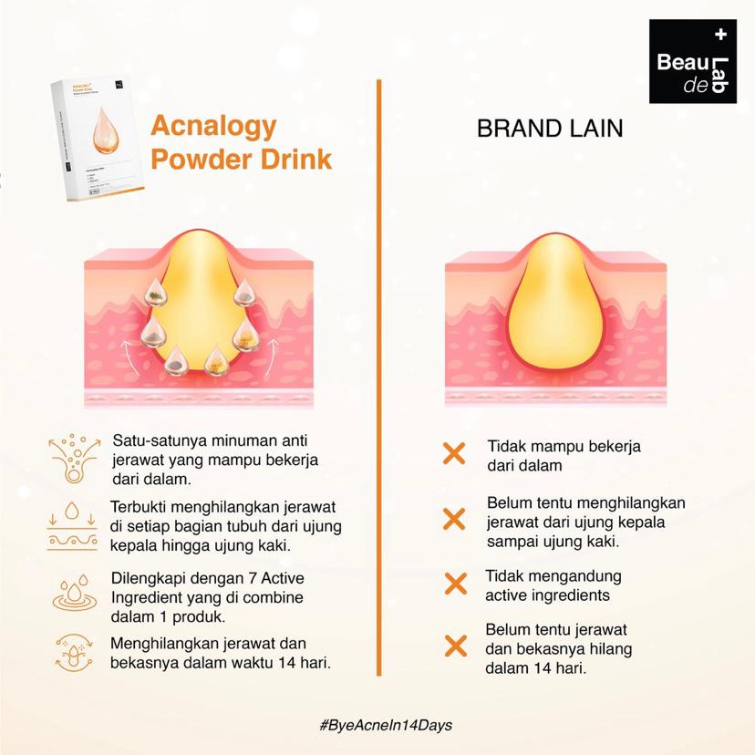 NEWLAB Acnalogy Powder Drink | Obat Minum Jerawat | Minuman Antioksidan | Penghilang Bekas Jerawat | Acne Treatment Drink