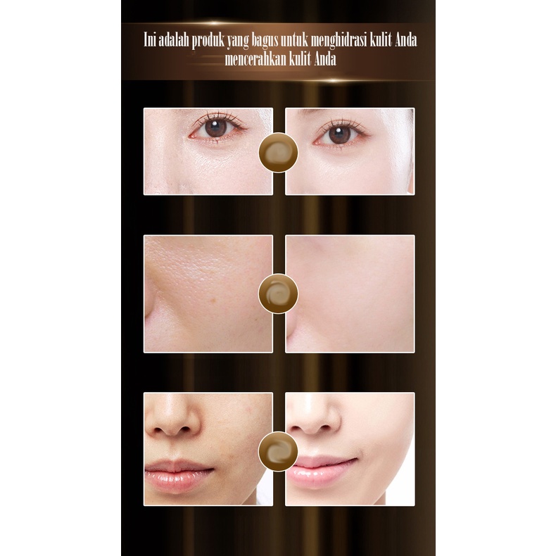 Skin Whitening&amp;Spot Membuang esensi 15 ml Remove Dark Spots Anti Freckle Cream Niacinamide Fade Pigmentation Melasma Brighten Creams Day Cream Night Cream Mencerahkan Kulit