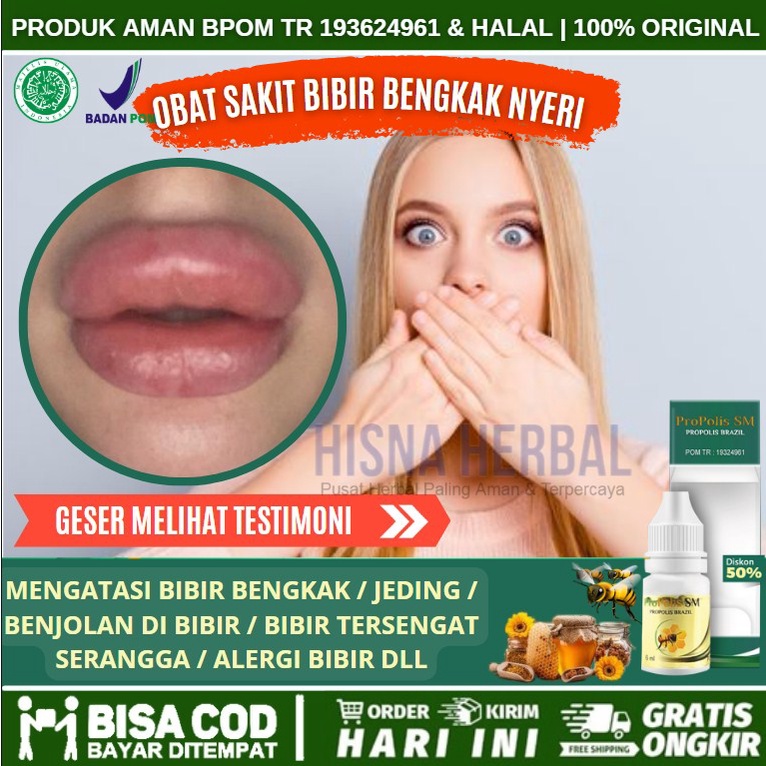 Obat Bibir Bengkak Karena Sariawan, Obat Tetes Bibir Pecah Pecah, Obat Oles Pelembab Bibir Yang Keri