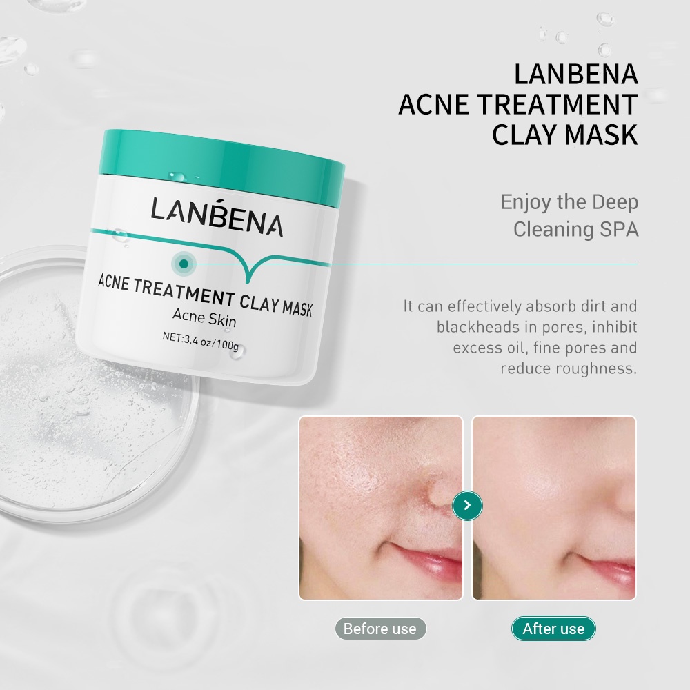(READY &amp; ORI) LANBENA ACNE TREATMENT CLAY MASK LB5613