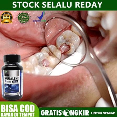 Obat Polip Pulpa Gigi, Tumbuh Daging Jadi di Gigi Berlubang/ Gusi, Polip di Gusi, Pengecil Polip Gig